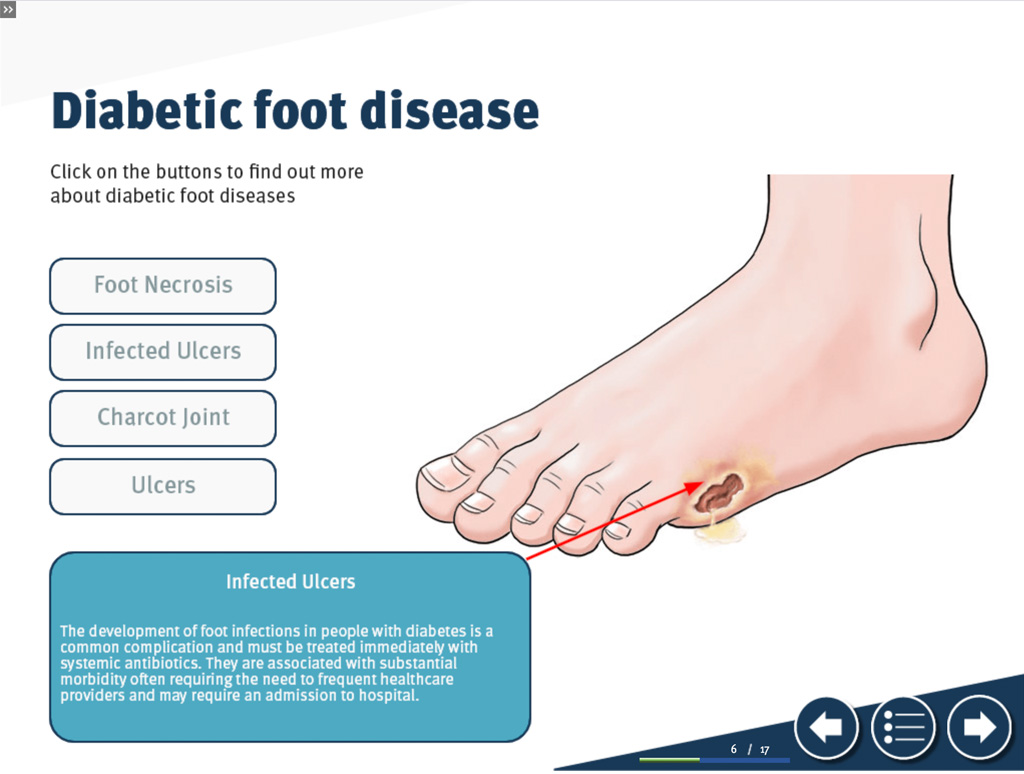 Diabetic Foot E-Learning - John Ryan Design